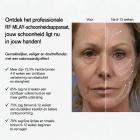 MLAY Professioneel RF-Schoonheidsapparaat voor Lifting, Toning, Rimpelverwijdering en Huidverstrakking van Gezicht en Lichaam – met Netvoeding