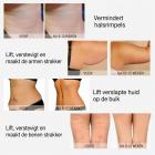 MLAY Professioneel RF-Schoonheidsapparaat voor Lifting, Toning, Rimpelverwijdering en Huidverstrakking van Gezicht en Lichaam – met Netvoeding
