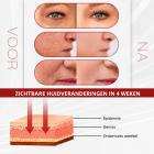 6-Kleuren LED-Lichttherapie Gezichtsverzorgingsapparaat met Kleurencyclus, 178 LEDs en Nano-Stoomspray – Fotodynamisch PDT Schoonheidsapparaat