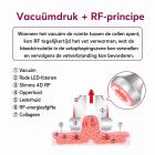 6in 1 80K Radiofrequentie-Cavitatieapparaat met EMS-Pads – Ultrasoon Afslanksysteem en Lichaamsmassageapparaat voor Vetverbranding en Cellulite