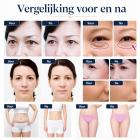 Mini 3in 1 RF-Schoonheidsapparaat voor Gezicht en Oogcontour – Huidverjonging, Lifting, Rimpelverwijdering en Huidversteviging