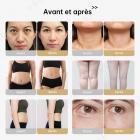 FREYARA Machine de cavitation RF 40K 3-en-1 (or rose), appareil de modelage corporel et d’amincissement, 3 têtes de massage pour le ventre, la taille, les bras, les jambes et les fesses, chargement par prise