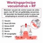 4in 1 80K Radiofrequentie-, Vacuüm- en Ultrasoon Cavitatieapparaat – Afslank- en Lichaamscontouringapparaat voor Gezicht, Armen, Taille, Buik en Benen