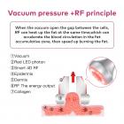 Machine de lipocavitation 5-en-1 RF 80 kHz avec aspiration – Cavitation ultrasonique minceur pour visage, bras, taille, ventre et jambes