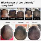 96 LLLT Laser Therapy Cap,Highly Focused Energy, Directly Reaching The Root of The Hair Follicle (5-8mm),Hair Regrowth Device