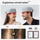 120-LED Lichttherapie Kappe FDA-zertifizierte Lösung für dickeren, gesünderen Haarwuchs