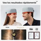 Gorro de fototerapia con 120 LED, una solución certificada por la FDA que le ayudará a conseguir un cabello más grueso y sano.Modelo con cable.