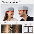 120-LED Roodlicht therapie haargroeikap, FDA-certificering haargroeikap voor mannen en vrouwen, Laserlichttherapiekap voor Haaruitvalbehandeling.Plug-in-stijl.