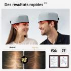 120 LED Casquette de Luminothérapie Capillaire, Approuvé FDA, Lumiere Rouge Therapie Casquette Laser de Repousse Capillaire, Stimule Croissance Cheveux