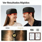Gorro de fototerapia con 120 LED, una solución certificada por la FDA que le ayudará a conseguir un cabello más grueso y sano.Modelo con cable.