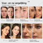 Uitgebreide anti-agingbehandeling: 4-kleuren LED-lichttherapie siliconenmasker voor versteviging en verheldering van gezicht en hals, 480 LED-parels