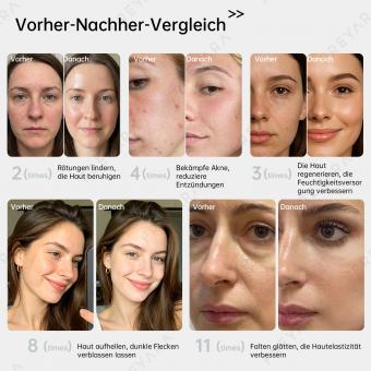 4-Farbige LED-Lichttherapie Silikonmaske für Gesicht und Hals – Vollständige Anti-Aging-Behandlung zur Straffung und Aufhellung mit 480 LED-Lichtern