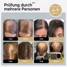 Bundle-Preis €279: 258-LED Rot & Blau Kappe + 4‑Farbige Silikonmaske (Gesicht & Hals) – Haarwachstum, Hautstraffung & Anti-Aging