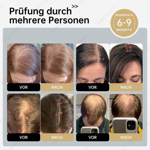 Bundle-Preis €279: 258-LED Rot & Blau Kappe + 4‑Farbige Silikonmaske (Gesicht & Hals) – Haarwachstum, Hautstraffung & Anti-Aging