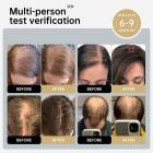 258 LED rød og blå lysterapihætte, hårgenvækstanordning til mænd og kvinder, trådløst design