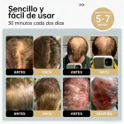 Gorro láser para el crecimiento del cabello LLLT 120, que enfoca la energía con precisión para llegar a las raíces del cabello (5-8 mm), gorro unisex para el crecimiento del cabello, solución para el tratamiento de la caída del cabello.