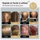 Capuchon de thérapie laser 120 LLLT, énergie hautement focalisée, atteignant directement la racine du follicule pileux (5-8 mm), dispositif de repousse des cheveux