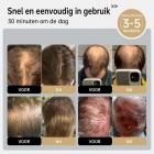222 LLLT Lasertherapiekap voor haargroei, zeer gerichte energie, bereikt direct de haarwortel (5-8 mm), haargroei hoed voor mannen en vrouwen, haaruitvalbehandeling