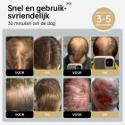 222 LLLT Lasertherapiekap voor haargroei, zeer gerichte energie, bereikt direct de haarwortel (5-8 mm), haargroei hoed voor mannen en vrouwen, haaruitvalbehandeling