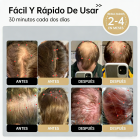 Gorro láser para el crecimiento del cabello LLLT 264, que enfoca la energía con precisión para llegar a las raíces del cabello (5-8 mm), gorro unisex para el crecimiento del cabello, solución para el tratamiento de la caída del cabello.