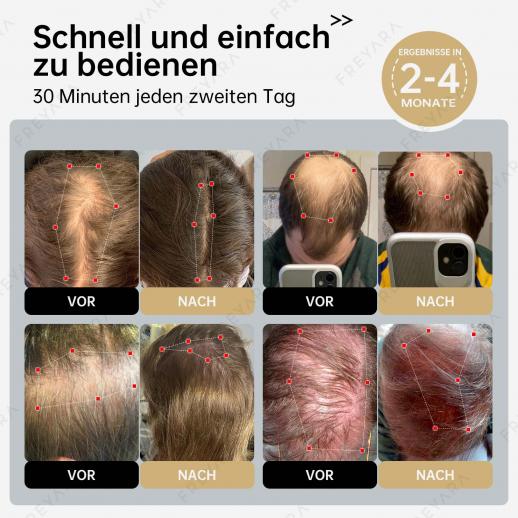 Bundle-Preis €669: 264 LLLT Laser-Therapie-Kappe + 4‑Farbige Silikonmaske (Gesicht & Hals) – Haarwachstum, Hautstraffung & Anti-Aging