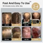 Gorro de terapia láser LLLT 264, energía altamente focalizada que llega directamente a la raíz del folículo piloso (5-8 mm), dispositivo para el recrecimiento capilar