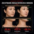 LED-FacialGlow 4D Professioneel 8-Kleuren LED-Lichttherapie Siliconenmasker voor Gezicht en Hals – Anti-Aging en Huidverheldering met 400 Lichtstralen-