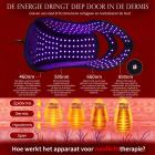 Professioneel 2-in-1 LED-Lichttherapie Gezichtsmasker & Haartherapiepet met 278 LEDs – 4-Golflengten Lichttherapie voor Gezicht en Hoofdhuid-