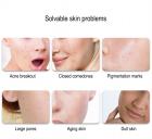 Professional 8-Color 756LED Light Therapy Mask for Face and Neck Anti-Acne, Whitening & Anti-Aging at Home