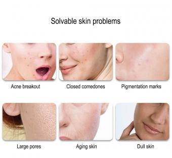 Professional 8-Color 756LED Light Therapy Mask for Face and Neck Anti-Acne, Whitening & Anti-Aging at Home