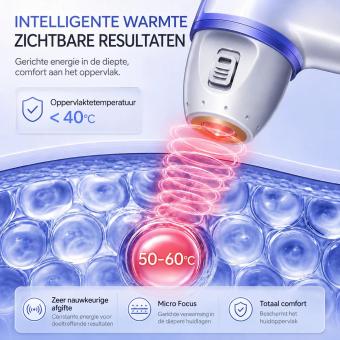 UC - FacialFirming 2.0 PRO Niet-Invasief i5 RF Ultrasoon Cannon Collageenbooster Schoonheidsapparaat – Diepe Collageenactivatie & Alles-in-één Anti-Aging Oplossing