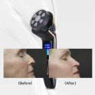 HIFU - FacialDefy 2.0, Handheld and Portable HIFU 4in1 Microfocused Ultrasound Machine,Upgraded Power, Faster Lift, Visible Results
