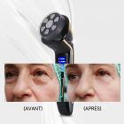 HIFU - FacialDefy 2.0, appareil à ultrasons microfocalisés HIFU 4 en 1 portable et portable, puissance améliorée, lifting plus rapide, résultats visibles