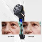 HIFU - FacialDefy 2.0, Handheld Und Tragbare 4-in-1 HIFU Mikro-fokussierte Ultraschallmaschine Für HIFU Behandlung & Facelifting, Verbesserte Leistung, Schnellere Straffung, Sichtbare Ergebnisse