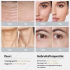 HIFU - FacialDefy 3.0, professionele HIFU RF-ultrasound-schoonheids- en faceliftmachine, anti-aging en rimpelverwijdering