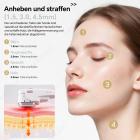 HIFU - FacialDefy 3.0, Professionelles HIFU RF Ultraschallgerät Für HIFU Behandlung & Facelifting, Hautstraffung, Anti-Aging- Und Faltenbehandlung