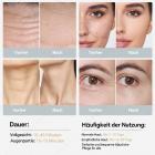 HIFU - FacialDefy 3.0, Professionelles HIFU RF Ultraschallgerät Für HIFU Behandlung & Facelifting, Hautstraffung, Anti-Aging- Und Faltenbehandlung