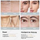 FREYARA FacialDefy 3.0 HIFU RF + Gel Conducteur 300 g