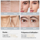 HIFU FacialDefy 3.0 – Technologie 3-en-1 (HIFU, RF, LED) appareil de lifting du visage, FDA-cleared HIFU machine pour lifting visage et anti-âge