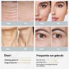 HIFU - FacialDefy 3.0, professionele HIFU RF-ultrasound-schoonheids- en faceliftmachine, anti-aging en rimpelverwijdering