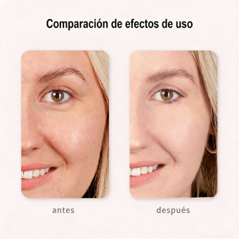 HIFU - FacialDefy 3.0 Lite, máquina de ultrasonido microfocalizado HIFU 2 en 1 para ojos y rostro, estimula la producción de colágeno y reduce las arrugas.