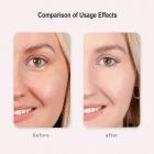 HIFU - FacialDefy 3.0 Lite, HIFU 2in1 Eye&Facial Microfocused Ultrasound Machine,Stimulate Collagen Production,Reduce Wrinkles