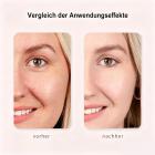 HIFU - FacialDefy 3.0 Lite, 2in1 Augen- & Gesichts-HIFU Ultraschallgerät Für HIFU Behandlung & Facelifting, Mikrofokussiert, Kollagenproduktion Anregen, Faltenreduzierung