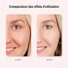 HIFU - FacialDefy 3.0 Lite, appareil à ultrasons microfocalisés HIFU 2 en 1 pour les yeux et le visage, stimule la production de collagène et réduit les rides.