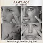 DPL+NIR - Photofacial 1.0, Professional Milk Light Photofacial Device,Erase Spots, Lift Skin&Anti-aging at Home