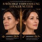 HIFU – FacialDefy 2.0 Pro, Professionelles HIFU Gerät für Gesichtslifting & Hautstraffung, Handgehaltenes Mikro-Ultraschall Hautverjüngungsgerät