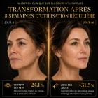 FREYARA HIFU - FacialDefy 2.0 Pro, appareil professionnel de lifting du visage et de raffermissement de la peau, appareil à ultrasons microfocalisés