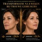 HIFU - FacialDefy 2.0 Pro, professionele draagbare HIFU-gezichtslifter en huidversteviger, microgefocuste ultrasone machine