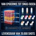 HIFU - FacialDefy 5.0, HIFU SculptTech schoonheidsapparaat, professionele lifting en versteviging voor gezicht en lichaam