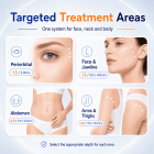  HIFU - FacialDefy 5.0, HIFU SculptTech Beauty Machine, Professional Lifting & Firming for Face & Body